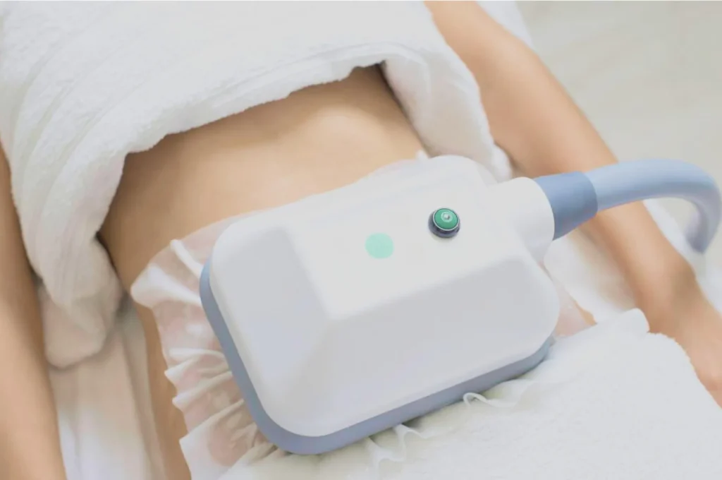 How Fat Freezing and HIFU Work Together? 3 advantages to combining Fat Freezing and HIFU East Kilbride