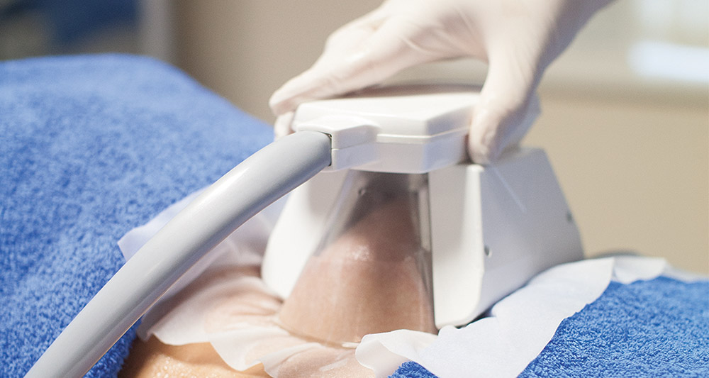 How Fat Freezing and HIFU Work Together? 2 Multiple Areas in One Session HIFU and Fat Freezing East Kilbride