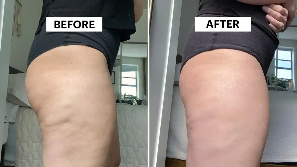 Do Toning Exercise East Kilbride Really Tackle Cellulite?