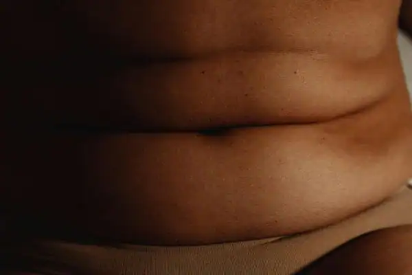 The Hidden Connection: How Stress Shapes Your Fitness and Body Composition 3 image of what stress can do on the stomach area and how Lipo 360 East Kilbride can help to change your body shape.