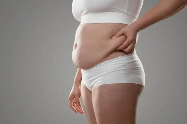 Image of stress belly East Kilbride How Lipo 360 can help manage your symptoms
